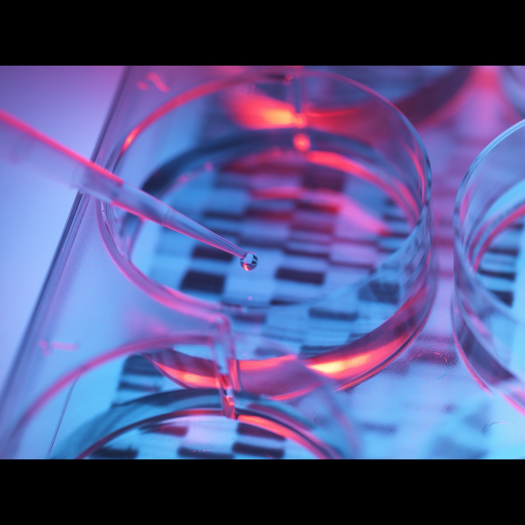 Amplirun® Neisseria Meningitidis Sg B DNA Control size:10,000size:20,000 c/µL